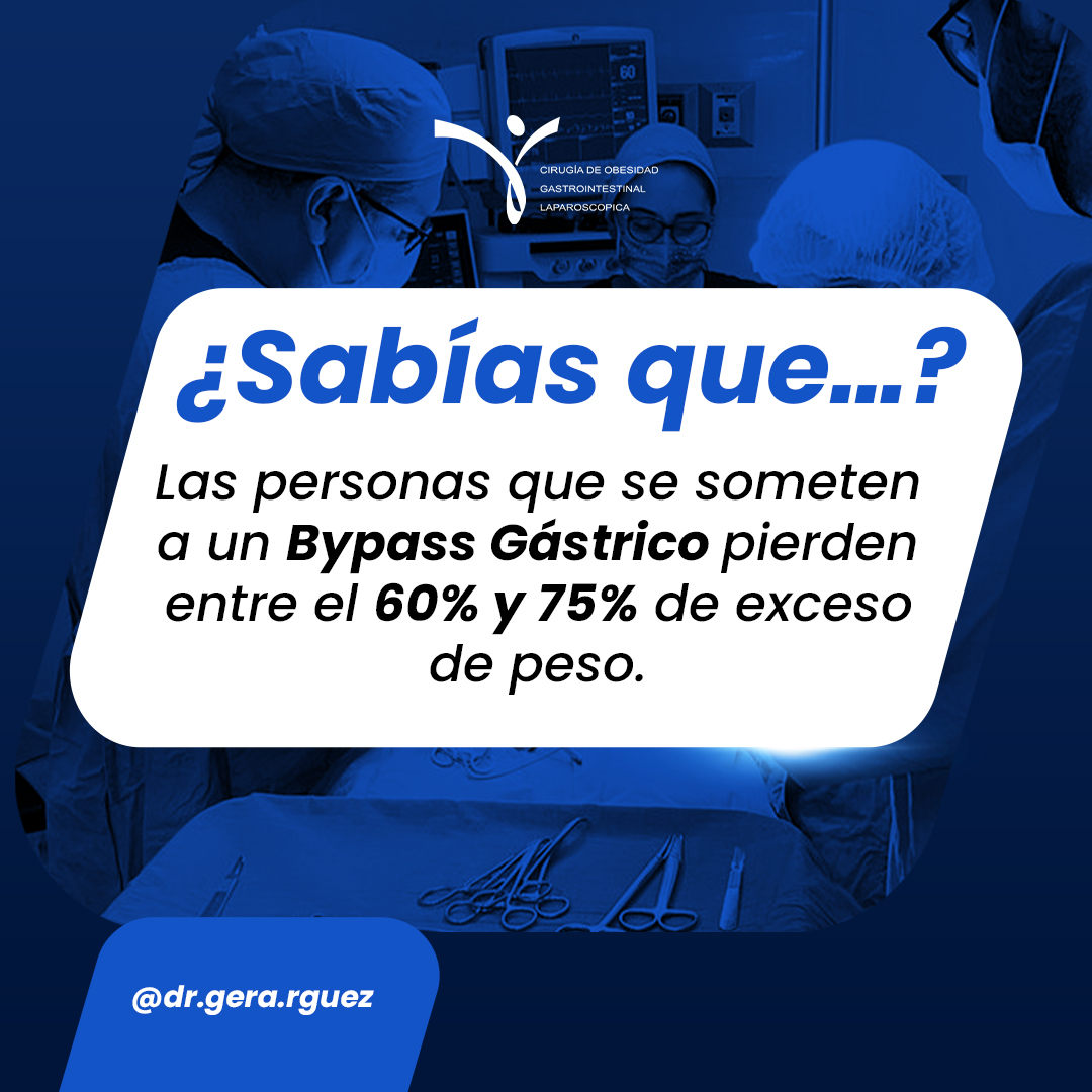 Las personas que se someten a un bypass gástrico pierden entre el 60% y 75% del exceso de peso