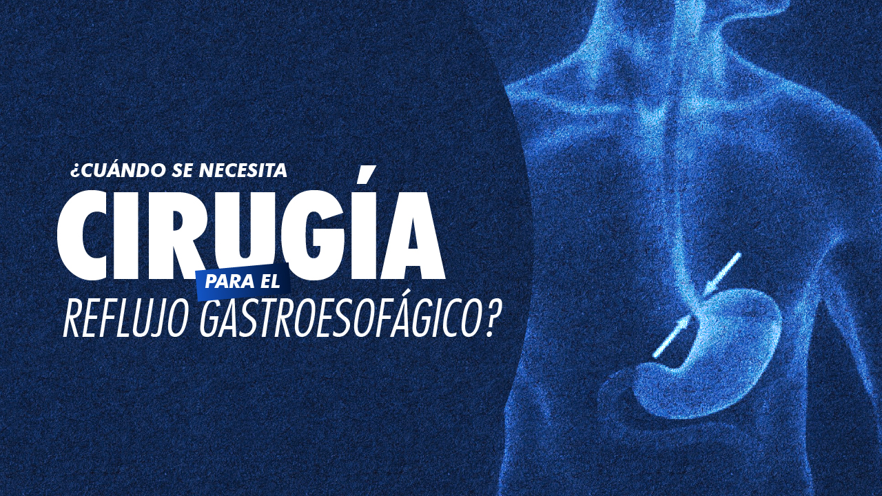 ¿Cuándo se necesita cirugía para el reflujo gastroesofágico?