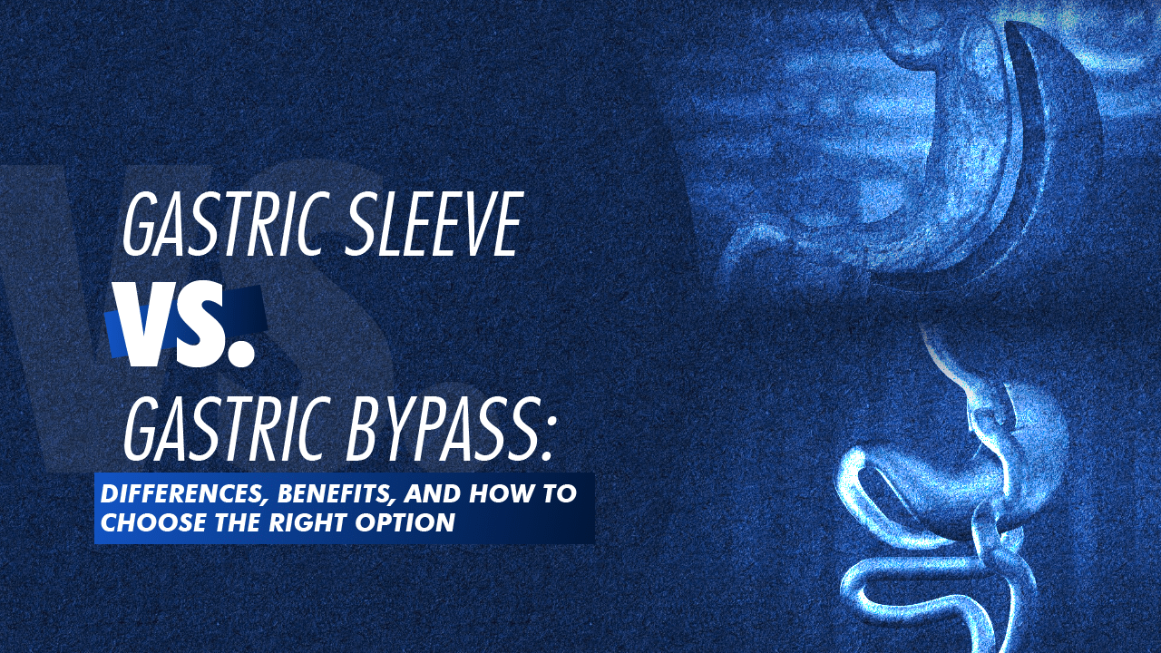 Portada · Gastric Sleeve vs. Gastric Bypass: Complete Comparison Guide